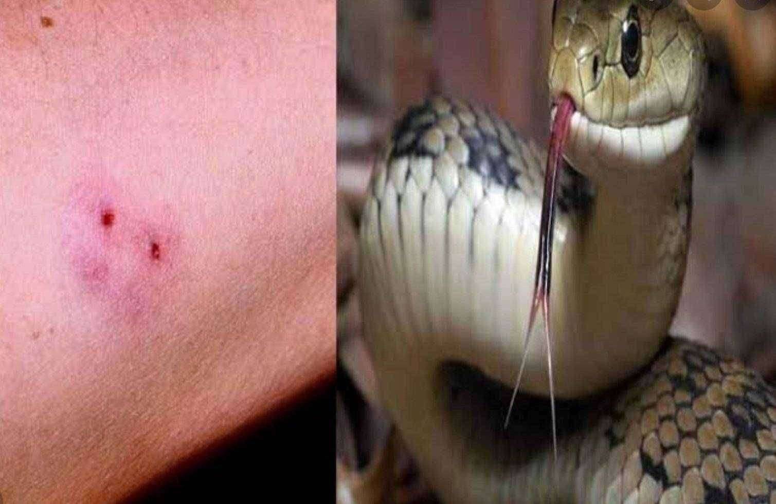 प्राथमिक आरोग्य केंद्र आरोग्य अधिकारी निष्काळजी व अपूर्ण सुविधा मूळे सर्प दवंश झालेल्या रुग्णाचा मृत्यू