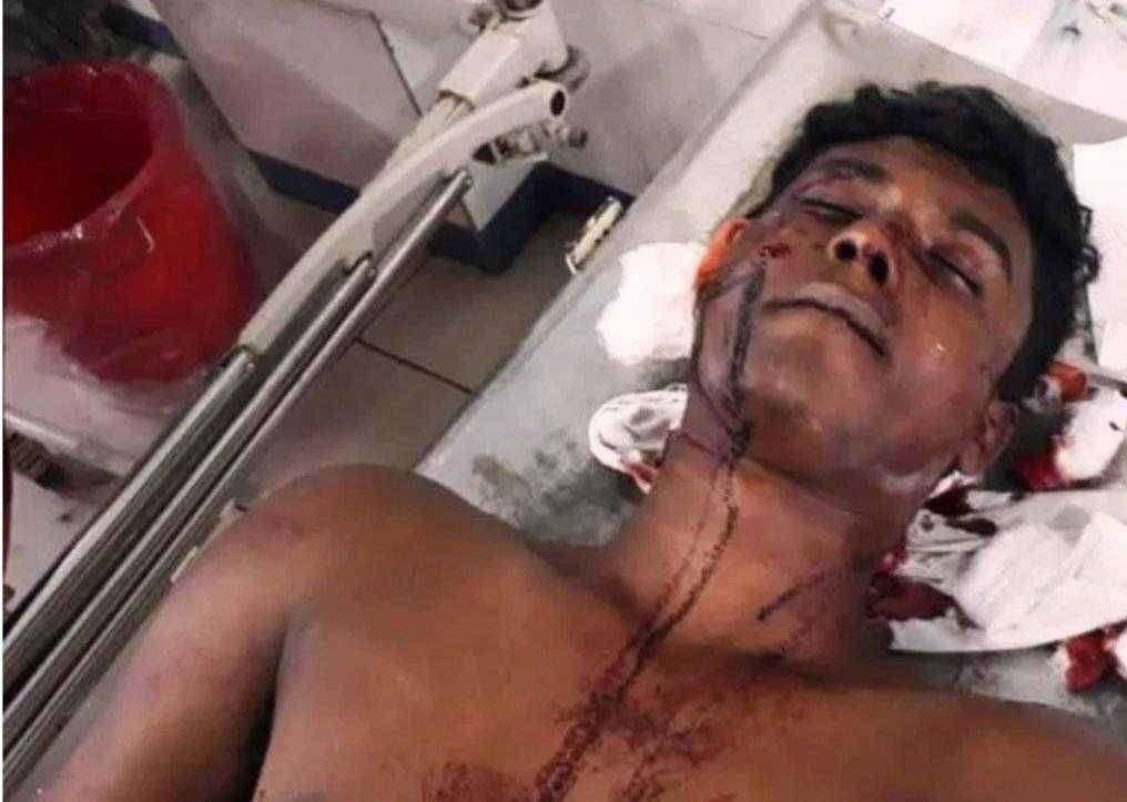 भुसावळात अज्ञात व्यक्तीकडून तरुणावर गोळीबर