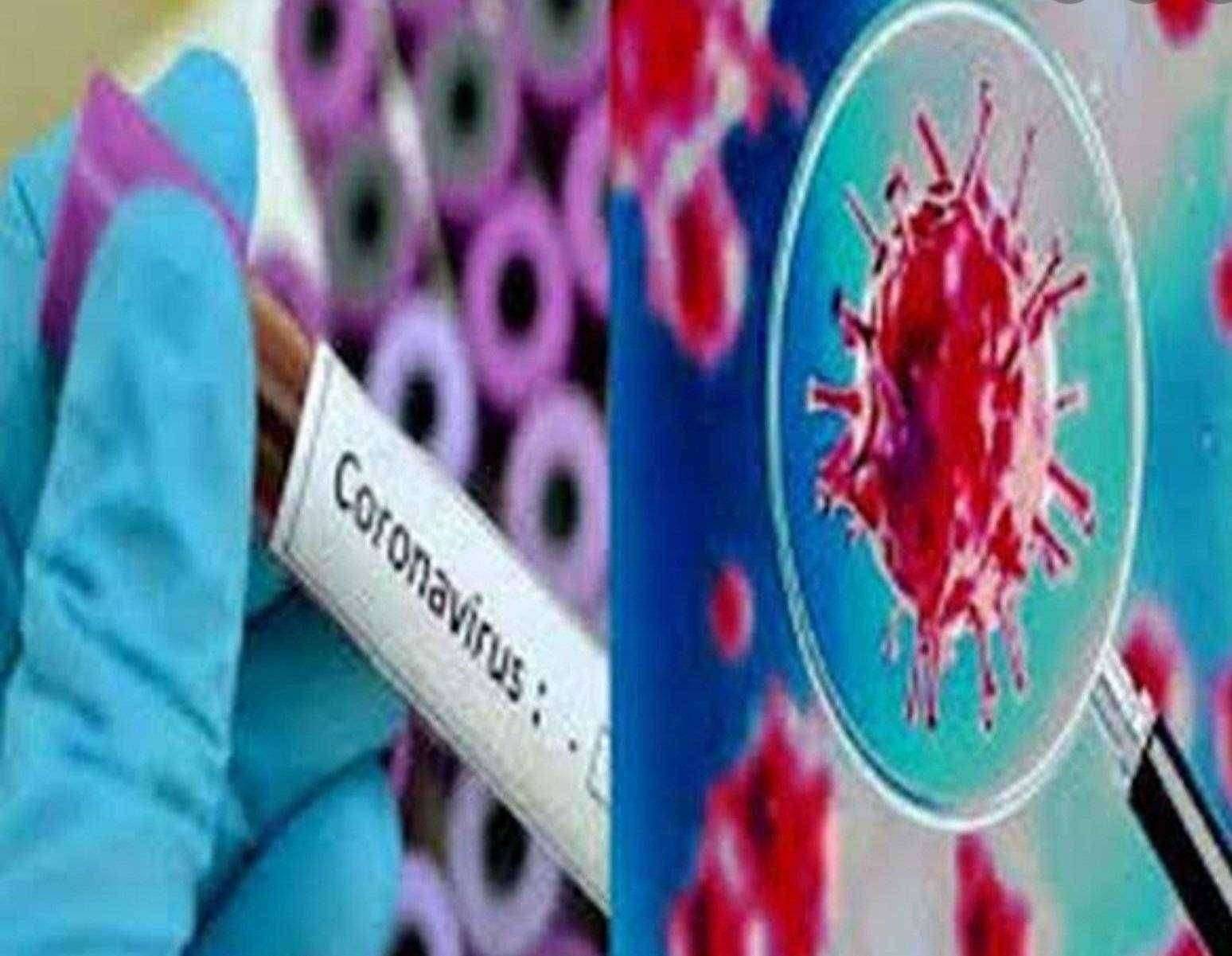 चंद्रपूर जिल्ह्यातील बाधितांची संख्या 7279 24 तासात 303 बाधिताची नोंद ; दहा बाधितांचा मृत्यू