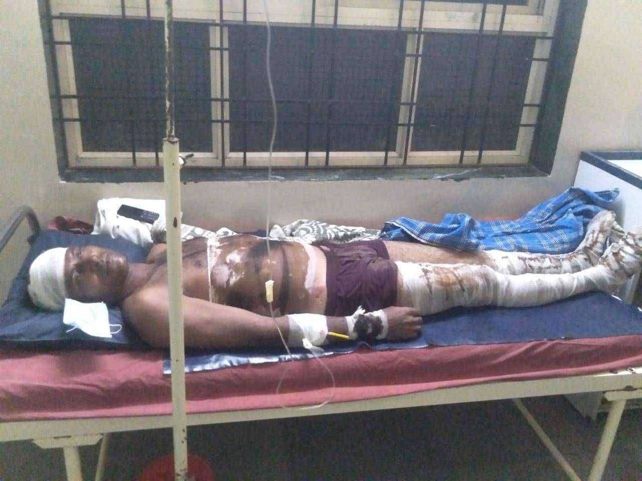 सावदा येथे उच्च दाब वीज तारांचे शाॅक लागल्याने कामगार जखमी