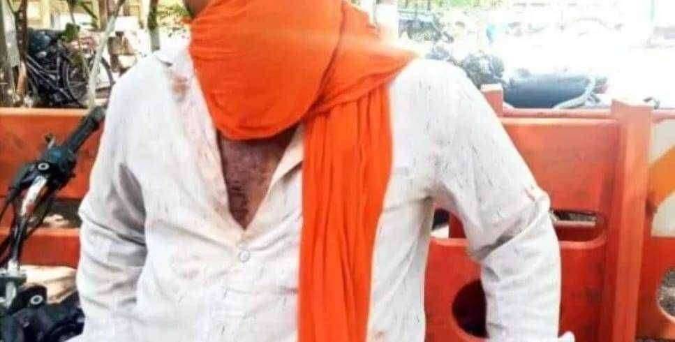 ? Crime Diary...जळगावात डोक्यावर बाटली फोडून फुटलेल्या काचांनी तरुणाच्या शरीरावर जखमा करत केली मारहाण