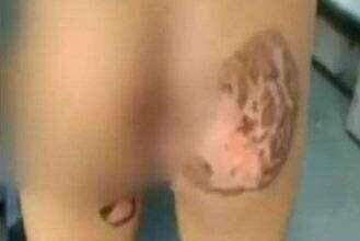 ? संतापजनक घटना..चड्डीत लघुशंका केल्याने चिमुकल्याला बापाने दिले चटके