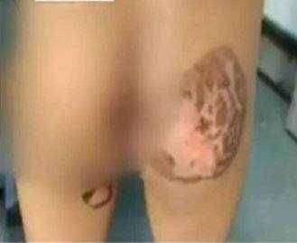 ? संतापजनक घटना..चड्डीत लघुशंका केल्याने चिमुकल्याला बापाने दिले चटके