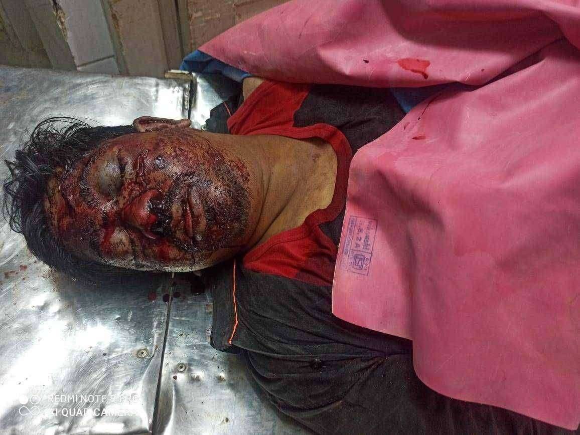 चोपडा येथील विरवाडे जवळ दोन मोटर सायकल मध्ये जोरदार धडक...