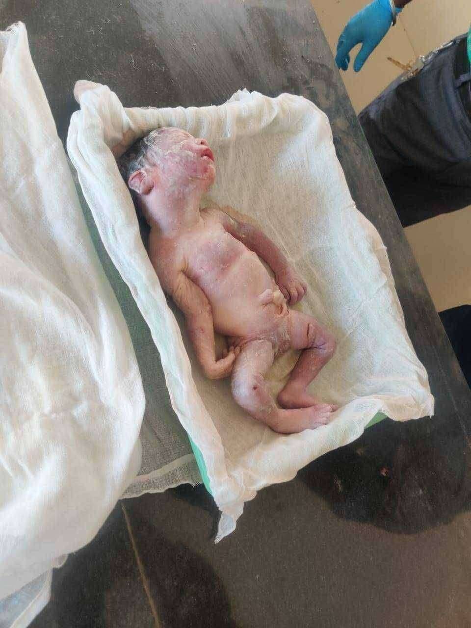 उपजिल्हा रुग्णालयाच्या संडासात मृत्यू अवस्थेत सापडले 7 महिन्याचे अभ्रक