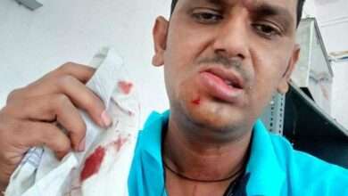 ऑक्सिजन फ्लो मीटर तोंडावर आदळून कोरोना योद्धा विक्की खोकरे जखमी...!! जखमी अवस्थेतही प्राणाची बाजी लावून कोरोना रूग्णाला हाॅस्पिटलला ऍडमिट करुन प्राण वाचवले.