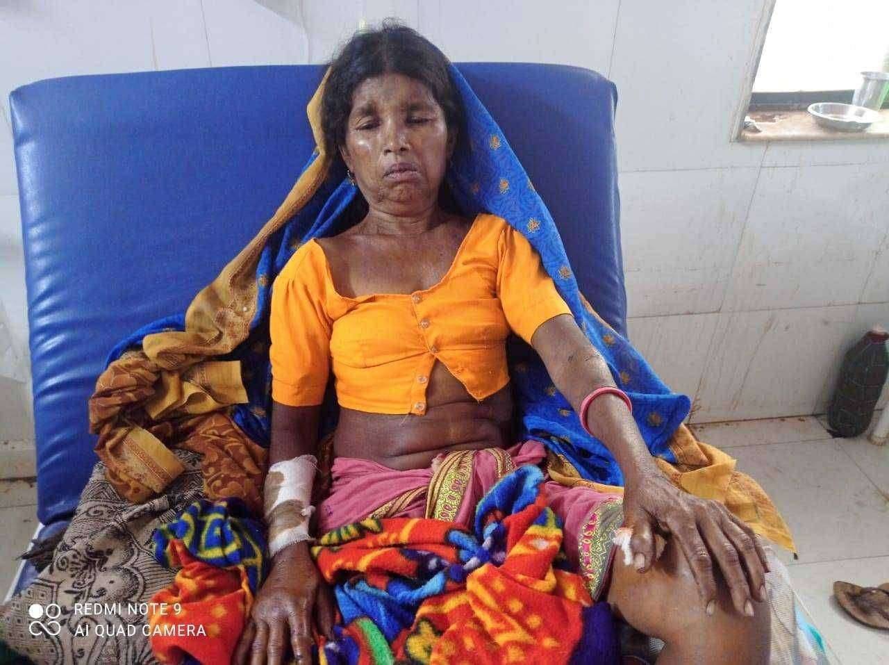 देवलदरी येथे आदिवासी महिलेवर रानडुक्कराचा जीवघेणा हल्ला. हल्ल्यात महिला गंभीर जखमी.