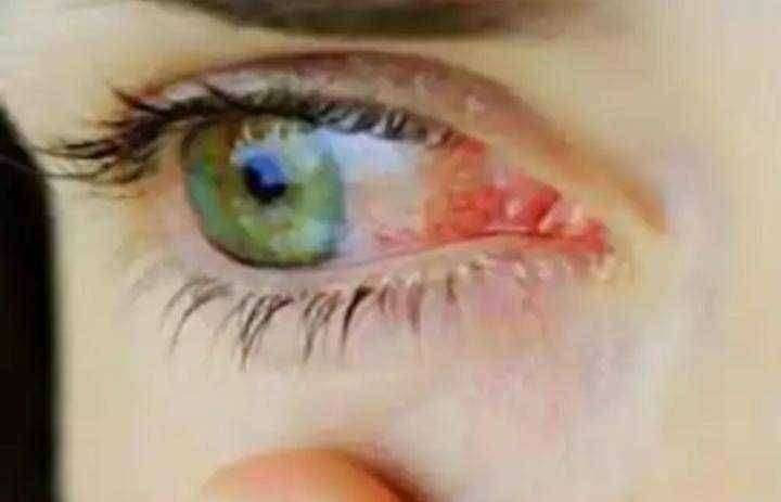 ? धक्कादायक! शहरात म्युकरमायकोसीसचे 274 रुग्ण