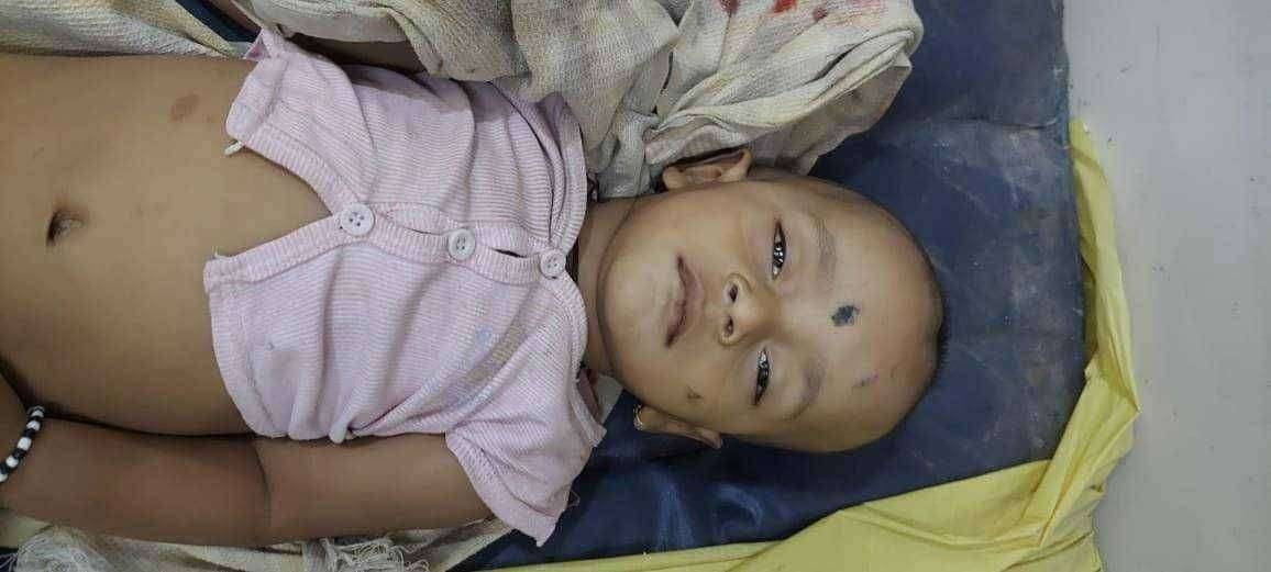 माणुसकीला काळीमा फासणारी घटना वाळुज मध्ये घडली आहे तीन वर्षीय चिमुकल्याचा जागीच मृत्यू , दोघांवर घाटी रुग्णालयात उपचार सुरू