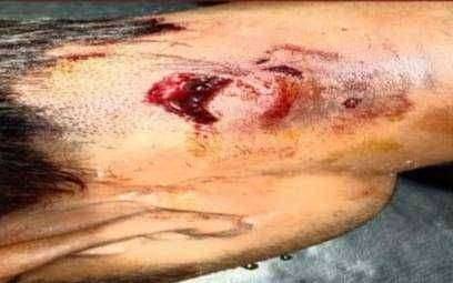 ?️अमळनेर कट्टा...विचारण्यास गेलेल्या एकावर विळ्याचा वार...!पोलिसांत गुन्हा दाखल...