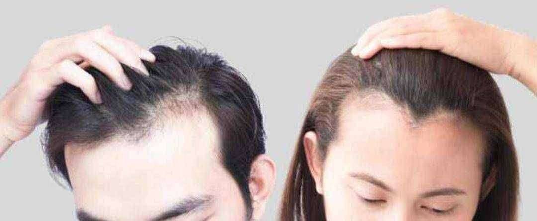 ?आरोग्य मंत्र..केसांच्या वाढीसाठी टिप्स