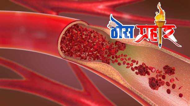 आरोग्याचा मुलमंत्र रक्तवाढी साठी चे घरगुती उपाय