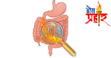 आरोग्याचा मुलमंत्र..अपचन आणि उपचार