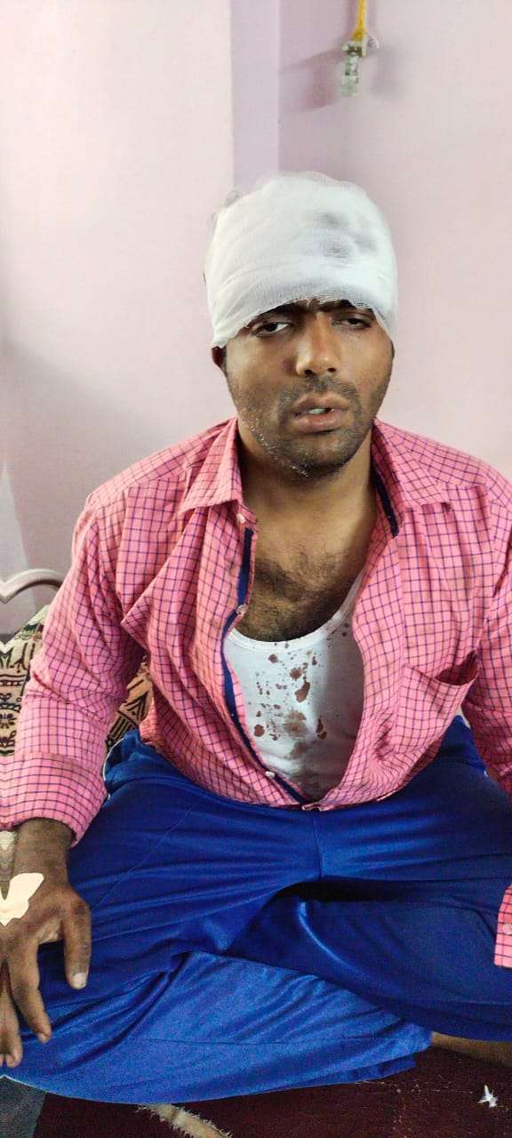 अमळनेर: दुकानातून घेतलेल्या वस्तूचे पैसे मागितले म्हणून दुकानदाराचे तोडले बोट..!