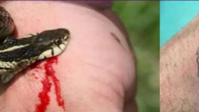 साप चावला..!घाबरू नका हे आहेत उपाय आणि उपचार..!
