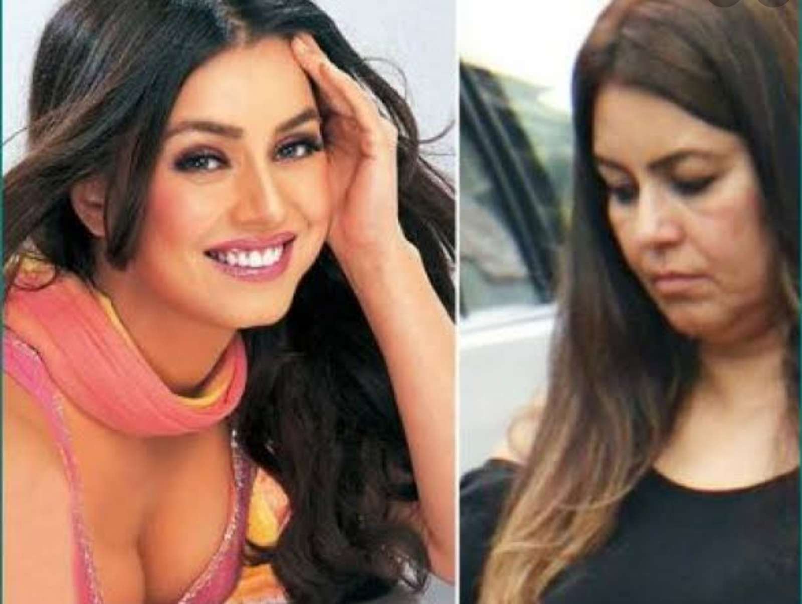 चेहऱ्यातून काढले 67 काचेचे तुकडे ..!"ह्या" लोकप्रिय अभिनेत्रीने अपघातात गमावलं सर्वस्व..