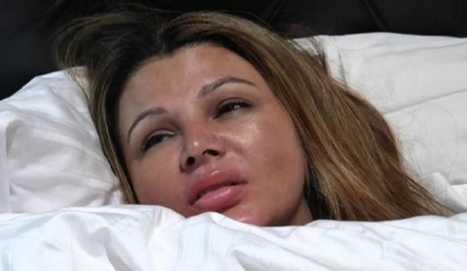 Bollywood: ड्रामा क्वीन राखी सावंत दवाखान्यात..!पार पडली मोठी शस्त्रक्रिया..!गेले दोन वर्षे झुंजत होती या आजाराशी..!