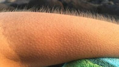 Important: अंगावर काटा येतो म्हणजे नेमकं काय..?