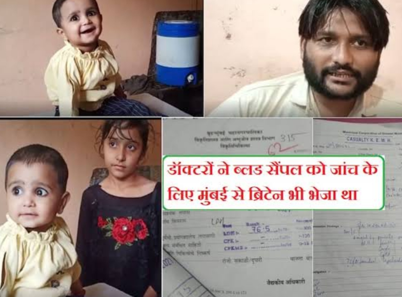 OMG: छोट्या निरागस अनायाच्या नसात लाल ऐवजी पांढरे रक्त..!रक्ताचे नमुने तपासणी साठी विदेशात..!