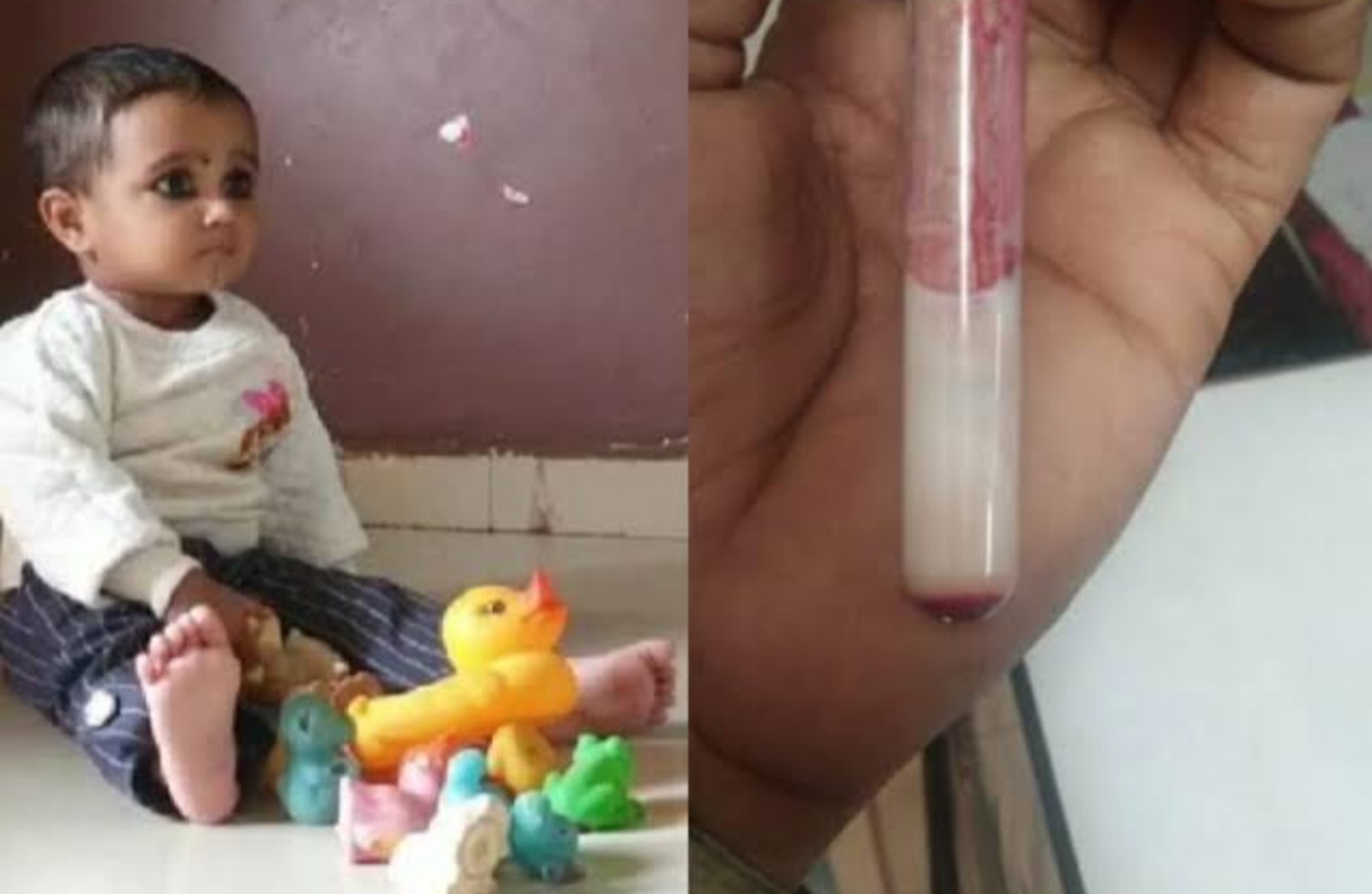 OMG: छोट्या निरागस अनायाच्या नसात लाल ऐवजी पांढरे रक्त..!रक्ताचे नमुने तपासणी साठी विदेशात..!