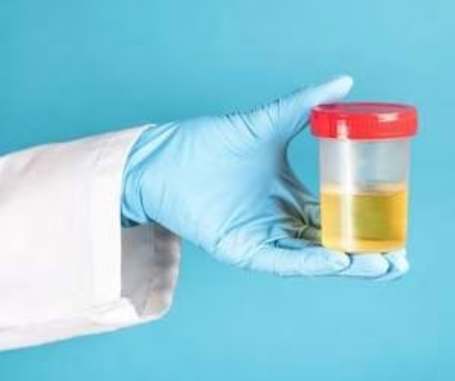 Health: लघवीचा रंग बदलला..? त्वरित डॉ ना संपर्क साधा..!